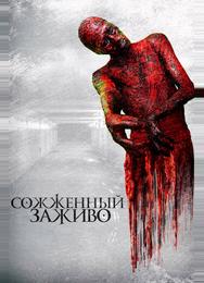 Сожженный заживо